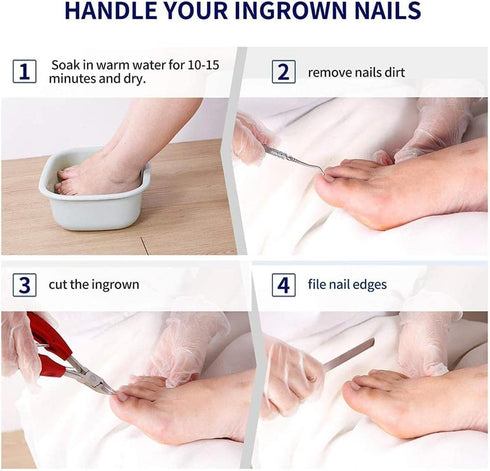 Toenail and Fingernail Clippers Set | Large Toenail Clippers for Ingrown or Thick Nails | Stainless Steel Nail Clippers