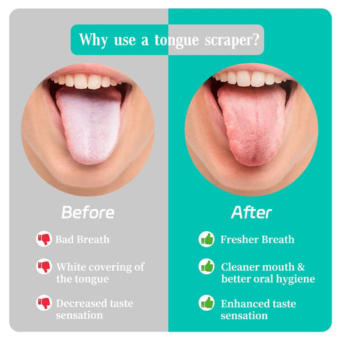 6 Pack Tongue Scraper for Adults, 100% Stainless Steel, Easy to Use Tongue Cleaner for Oral Hygiene