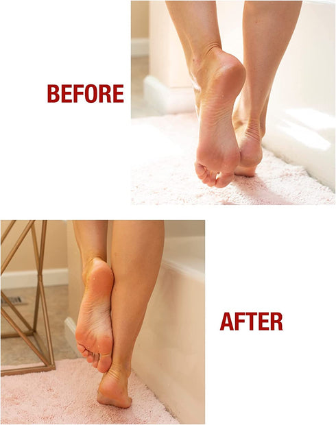 Kerasal Intensive Foot Repair Skin Healing Ointment, 1 Oz with Moisturizing Gel Socks, One Pair (Packaging May Vary)