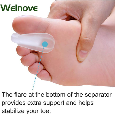 Welnove Toe Separators for Bunions, Gel Overlapping Toe Spacers, Bunion Corrector for Pain Relief, 10 Pack