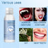 Tooth Repair Kit, Teeth Replacement Kit for Temporary Restoration of Missing & Broken Teeth Replacement Dentures