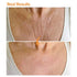 PAPABA 2 Pack Chest Wrinkle Pads, Reusable Medical Grade Silicone Patches for Anti-Wrinkle Decollete, 2 Patches