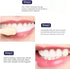 YG LianKai 2PC Niacinamide Toothpaste, Niacinamide Whitening Toothpaste, Intensive Nicotinamide White Teeth, Fresh
