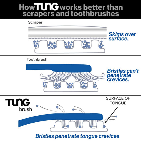 TUNG Tongue Gel by Peak Essentials | Mint Blast Natural Cleaning Paste | 2 PACK | Bad Breath Eliminator, BPA Free