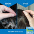 Pack) Eczema Shampoo & Conditioner (Combo - Flare Control Scalp & flake Relief Therapy that Protects, Moisturizes