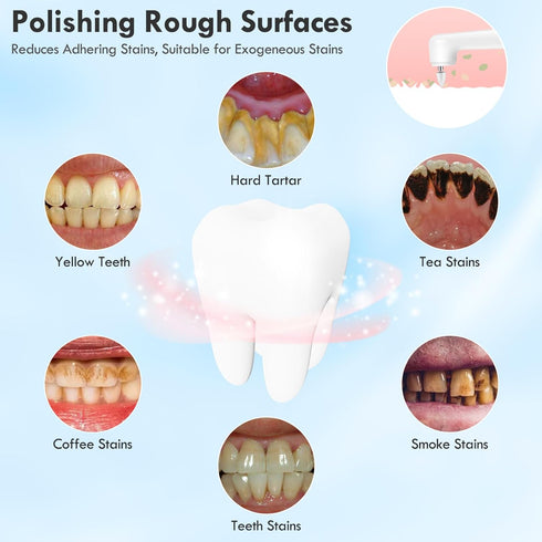 Rechargeable Tooth Polisher Kit - Electric Dental Teeth Polisher with LED Light, 5 Brush Heads