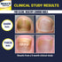 Nail Clarifying Gel, Clinically Proven for Discolored and Damaged Toenails, Effective Treatment
