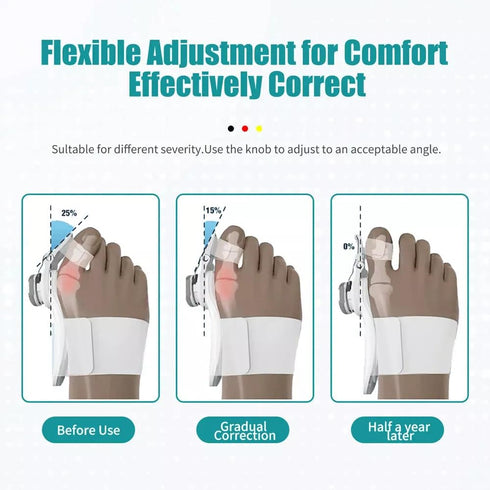 Toe Corrector, Orthopedic Bunion Straightener, Adjustable Toe Separator for Pain Relief
