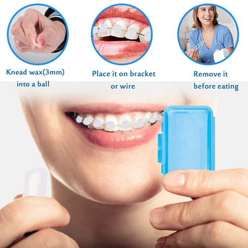 Braces Wax for Teeth, 12 Pack Dental Care Orthodontic Wax for Braces Wearers, Colorful