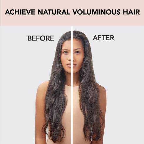 Kitsch Hair Roller Clips, Instant Volumizing Clips for Women, Easy to Use Volume Hair Clips for All Hair Types, 2 Pcs