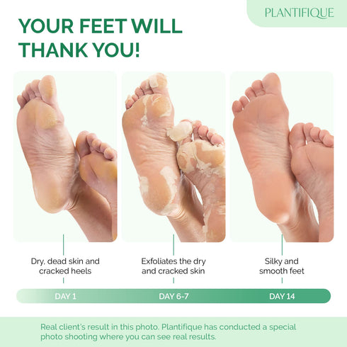 PLANTIFIQUE Jasmine Foot Peeling Mask 1 Pair | Dermatologically Tested for Baby Soft Feet, Repairs Heels & Removes Dry