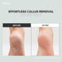 Stainless Steel Callus Remover, Sky Blue, Effective for Thick Callus and Cracked Feet