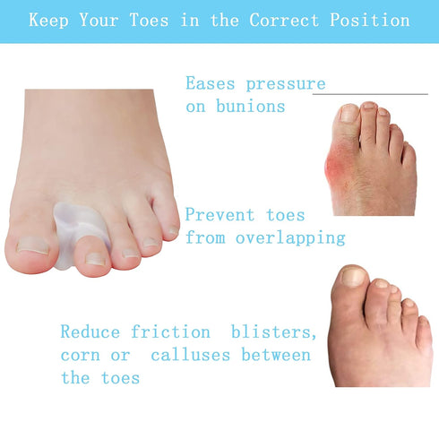 Pack of 12 Gel Toe Separator, 1/4" Thick Big Toe Spacers, Single Loop Corrector and Spacer for Bunions (Clear)