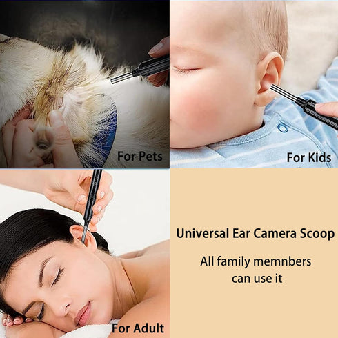 Ear Wax Removal Tool with Camera and Light, Ear Cleaning Kit for iPhone, iPad, Android Phones
