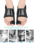 Bunion Corrector and Splint, Orthopedic Bunion Relief for Hallux Valgus Pain, Fits Men and Women