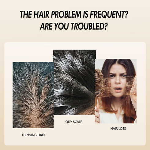 Onion Oil for Hair Growth, Organic Rosemary Hair Growth Oil with Black Seed Oil to Control Hair Loss and Promote Growth