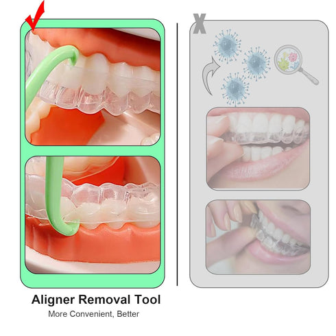 Aligner Removal Tool, Portable Clear Tool for Invisalign Retainers, Braces, Aligners, 8PCS Hook Pull Tool