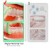 Aligner Removal Tool, Portable Clear Tool for Invisalign Retainers, Braces, Aligners, 8PCS Hook Pull Tool