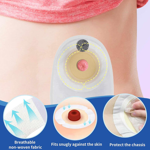 ovand (40pcs) Ostomy Barrier Strips - Ostomy Barrier Tape,Ostomy Supplies,Medical Grade Adhesive Barrier Strips Better
