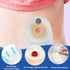 ovand (40pcs) Ostomy Barrier Strips - Ostomy Barrier Tape,Ostomy Supplies,Medical Grade Adhesive Barrier Strips Better