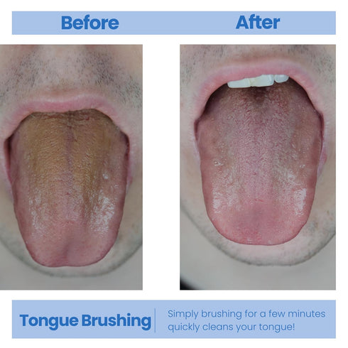 Tongue Scraper for Fresh Breath, Perfect for Adults and Kids, 3 Pack for Oral Hygiene and Bad Breath