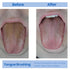 Tongue Scraper for Fresh Breath, Perfect for Adults and Kids, 3 Pack for Oral Hygiene and Bad Breath