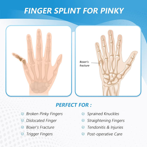 Pinky Finger Splint, Finger Splint for Broken Finger, Trigger Finger, Metacarpal Splint Hand Brace for Tendonitis Pain