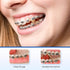 JMU Orthodontic Elastics 3/8 Heavy, 300 Pack of Rubber Bands, Intraoral Latex Dental Bands