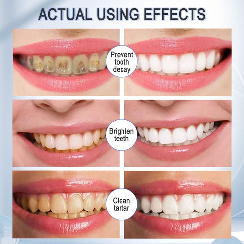 Teeth Whitening Toothpaste with Fluoride, 2 Pack Mousse Foam for U-Shape Electric Toothbrush