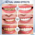 Foam Toothpaste, Whitening Baking Soda Toothpaste, Ultra-fine Mousse Foam for Great Oral Care & Whitening