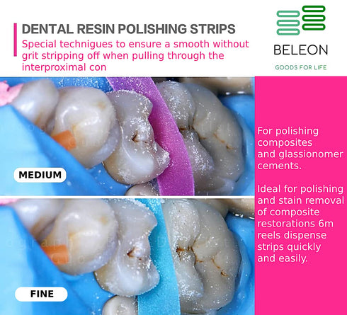 Dental Polishing Strips - Tooth Polisher Dental File for Deep Teeth Cleaning, Fine 1 Roll 2.5mm x 6M