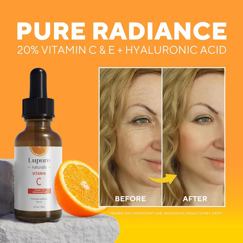 Professional Vitamin C Face Serum 20% - Anti Aging Facial Serum with Hyaluronic Acid & Vitamin E, 1 Fl. Oz