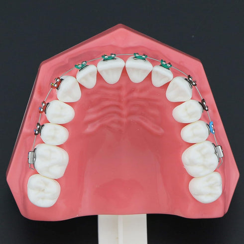 Dental Models Orthodontic Model M7010-2, 1:1 Standard Typodont Teeth with Archwire Ligature Ties, Metal Brackets