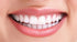 Portable Dental Water Flosser, Cordless Teeth Cleaner with 3 Cleaning Modes, Rechargeable FineLife Products - Silver