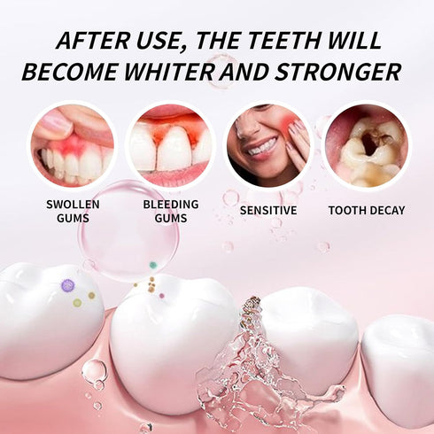 Set (10% 4PCS (4) Hydroxyapatite Toothpaste n-HAp) - Day & Night Oral Care with Niacinamide for Enamel Repair