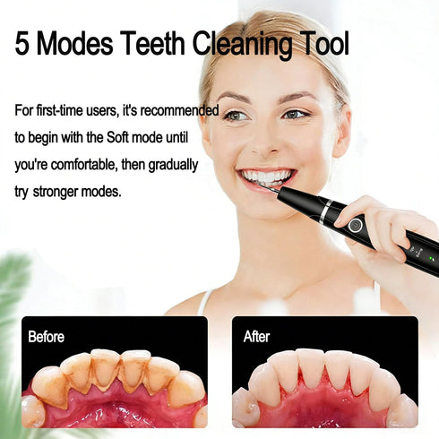 Ujhosld 5 3 IPX6 Sonic Electric Toothbrush, Dental Cleaner with LED Light, Modes Teeth Cleaning Tool, Replaceable Heads