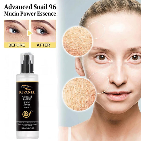 Snail Mucin 96% Power Essence Repairing Facial Serum, 3.38 fl.oz for Fine Lines & Dull Skin