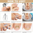 Ingrown Toenail Removal Kit, Professional Tool Kit with Corrector, 50PCS Corrector Patches for Pain Relief