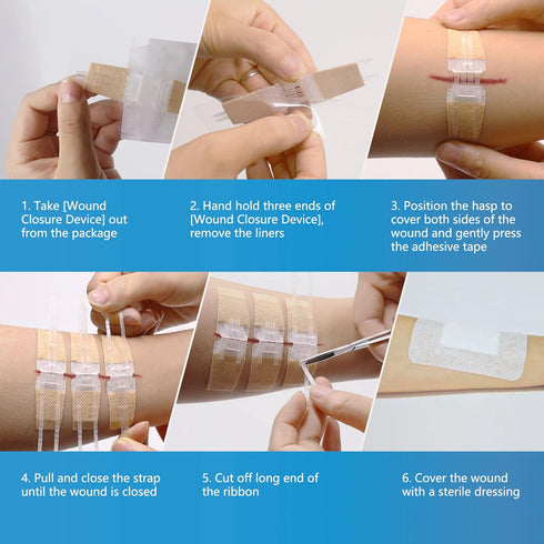 SEABIRD Zip Sutures Wound Closure Device, Emergency Laceration Kit with Bandages and Steri Strips Pack of 2