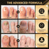 Toenail Fungus Treatment Extra Strength Pen for Damaged Toenail & Finger, More Pure Natural Plant Extracts, Toe Nail