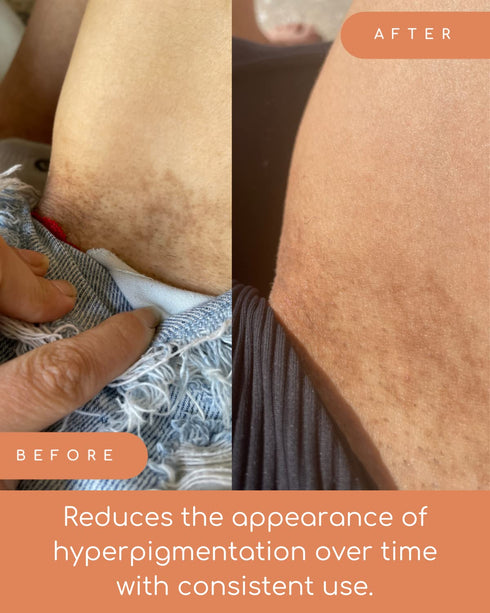 The Down Low Inner Thigh Serum - Helps Dark Spots on Bikini Area & Inner Thighs