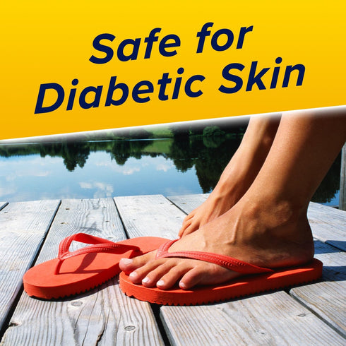 Aspercreme Odor Free Lidocaine Foot Pain Relief Cream - 4 oz., Safe for Diabetic Skin