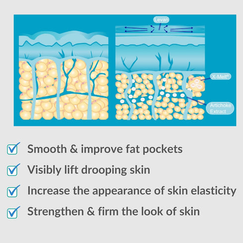 Serious Skincare Cryo-Cinq Sculpting Body Treatment Cream with Slimexir - Skin Firming and Tightening for Cellulite, 8