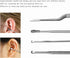 6 Pcs Ear Pick Ear Curette - LED Light Earwax Removal Cleaner with Stainless Steel Storage Box