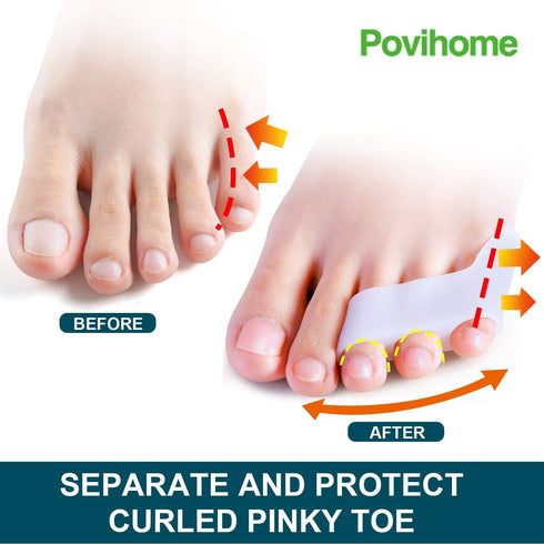 Povihome 10 Pack Pinky Toe Separator and Protectors, Triple Gel Toe Separators
