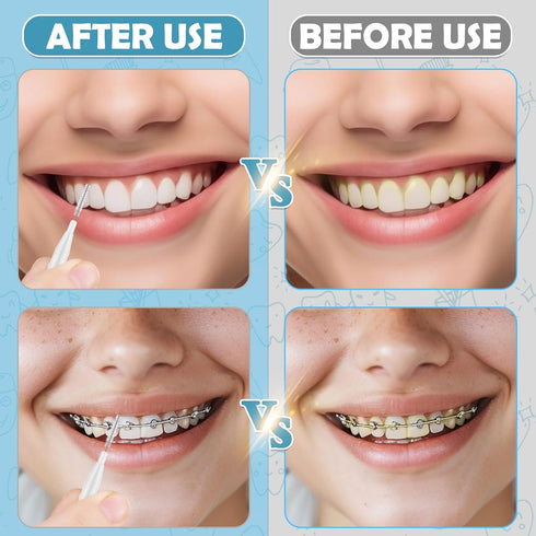 120 Pieces Braces Dental Brush Flosser, 360° Bendable Toothpick, Soft Bristles for Oral Hygiene