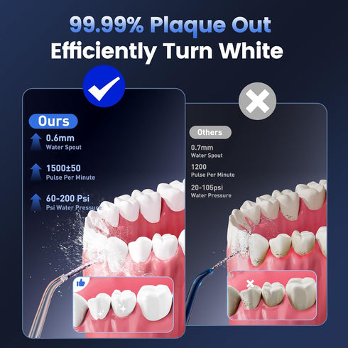 Reure 5 320ml IPX7 Water Flosser for Teeth Cleaning and Flossing, Modes Rechargeable Cordless Oral Irrigator Water Tank