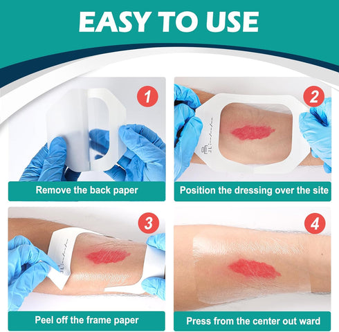 YHOVID 4" 4.75" 80 Swimming, Transparent Film Dressing x Box of - Waterproof Bandages for Showering, Wounds, Post