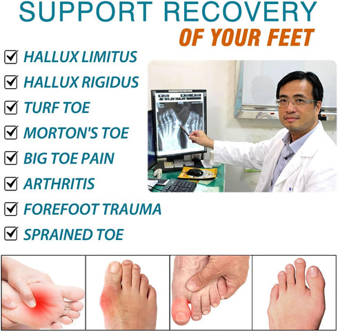 1 Pair Carbon Fiber Insole for Turf Toe, Morton Toe, Foot Fractures, Arthritis, Hallux Rigidus, Rigid Orthotic Inserts