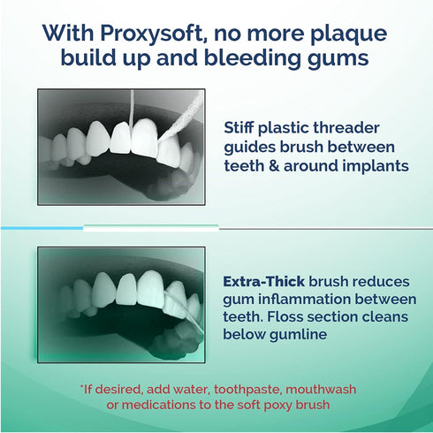 ProxySoft Periodontal Floss 5pk 250 Strands
